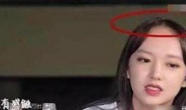 明星大爆料掉头发视频,揭秘掉发背后的惊人真相！